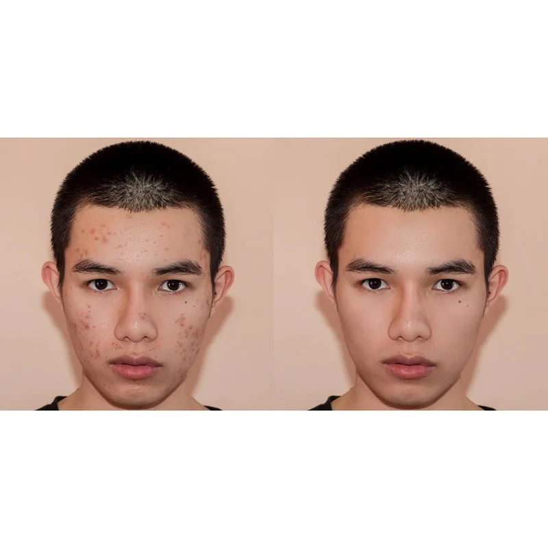 SkinSafer | Lubaru
