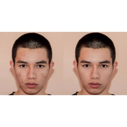 SkinSafer | Lubaru